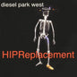 Diesel Park West : Hip Replacement (CD, Album)